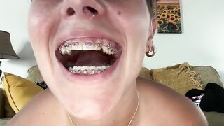 Watch renimoonxo HD Porn Video [Chaturbate] - talkative, new, milf, 18, tattoos